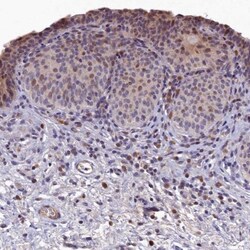 LATS2 Antibody, Novus Biologicals:Antibodies:Primary Antibodies